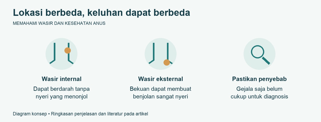 Benjolan Anus yang Mendadak Sangat Nyeri dan Wasir Trombosis