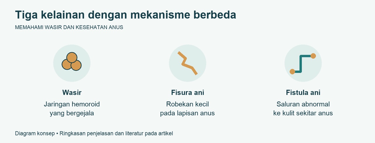 Membedakan Wasir Fisura Ani dan Fistula Ani