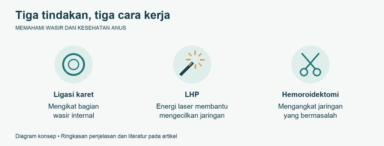 Memilih LHP Biolitec Ligasi atau Hemoroidektomi dan Menilai Biayanya