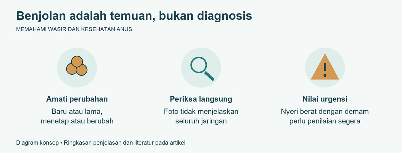 Mengenali Wasir Dalam dan Wasir Luar