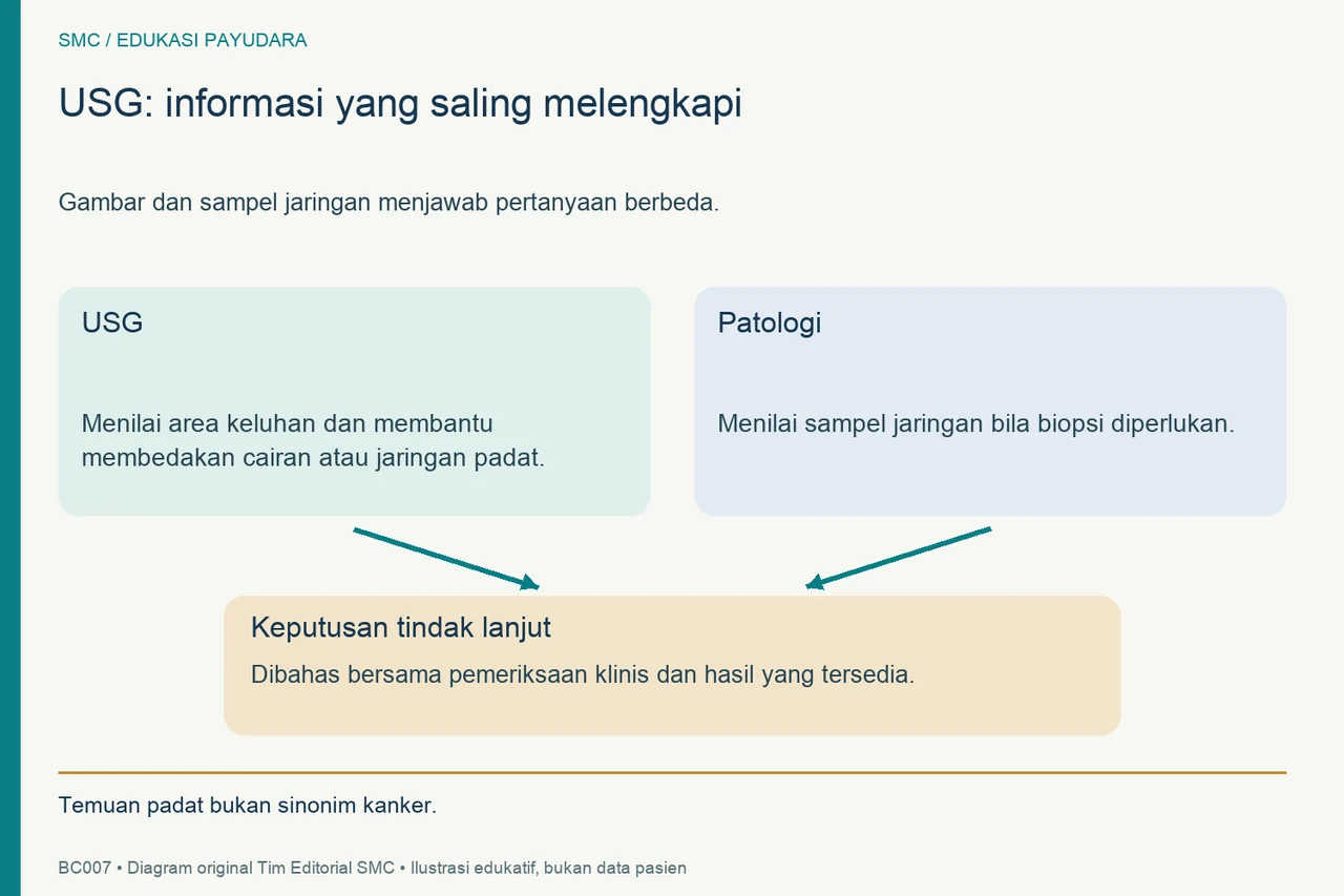 Dua masukan USG dan patologi bertemu dalam keputusan tindak lanjut; temuan padat tidak otomatis berarti kanker.