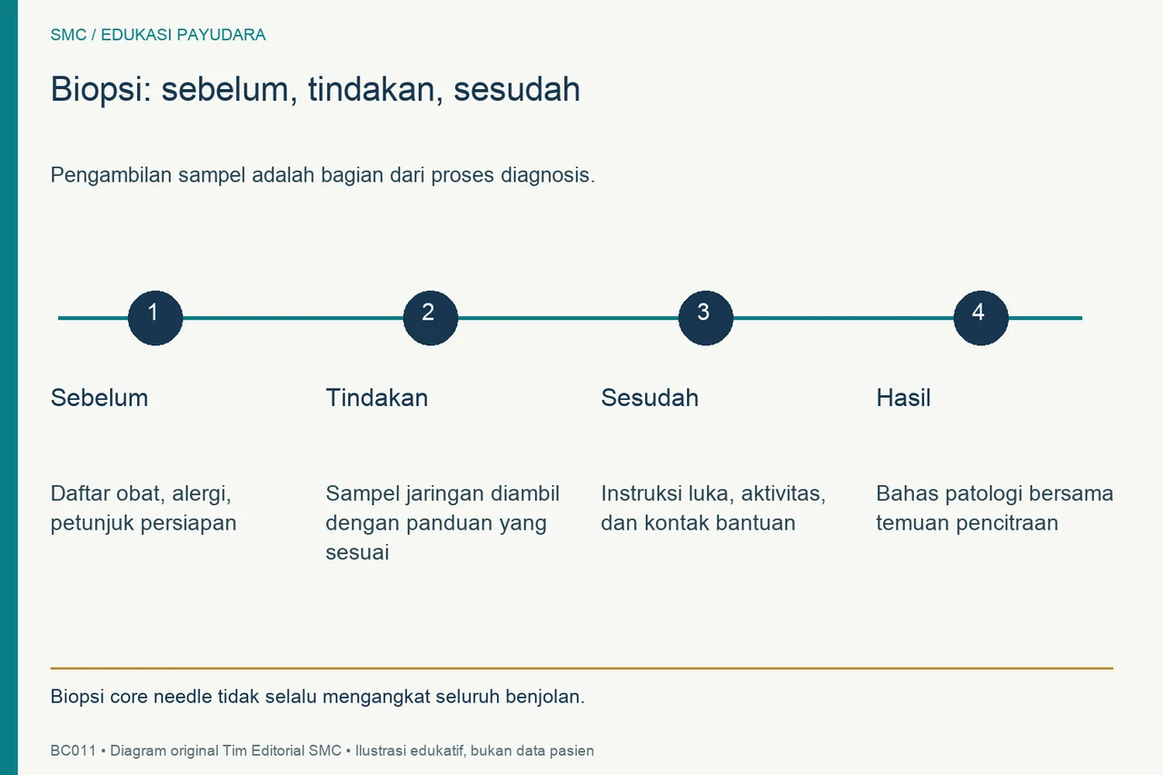 Empat tahap biopsi core needle: persiapan, pengambilan sampel, perawatan sesudah, dan pembahasan hasil.
