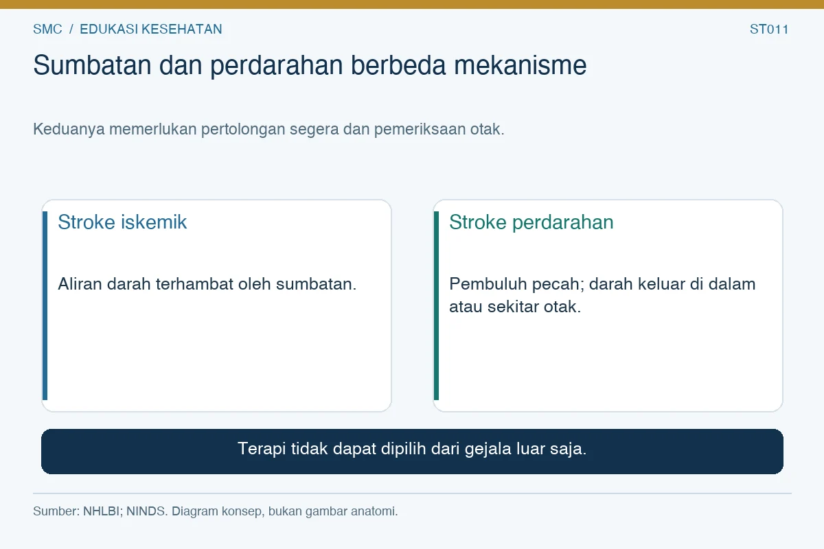 Sumbatan dan perdarahan berbeda mekanisme. Stroke iskemik: Aliran darah terhambat oleh sumbatan. Stroke perdarahan: Pembuluh pecah; darah keluar di dalam atau sekitar otak.